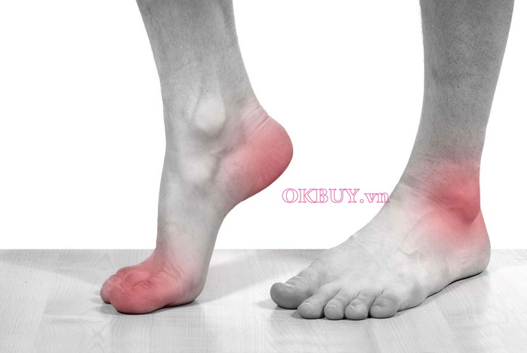 Bệnh gout có thể gây bệnh đau nhức xương khớp đến cho người bệnh