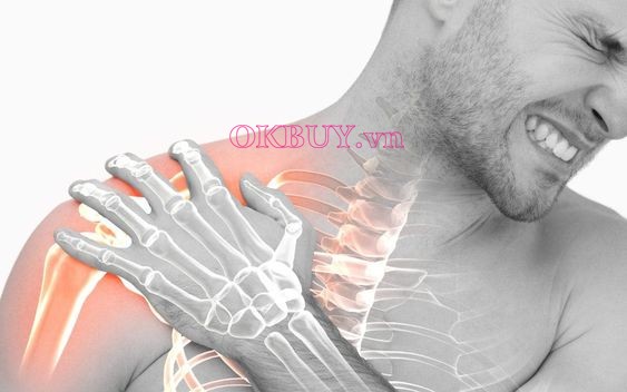Gãy xương đòn gây ra tình trạng đau bả vai lan xuống cánh tay