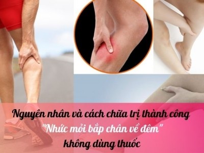 Nhức mỏi bắp chân về đêm: Nguyên nhân và cách chữa trị thành công không dùng thuốc