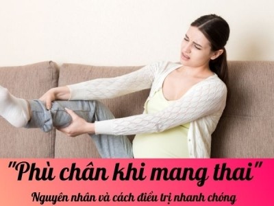 Phù chân khi mang thai: Nguyên nhân và cách điều trị nhanh chóng