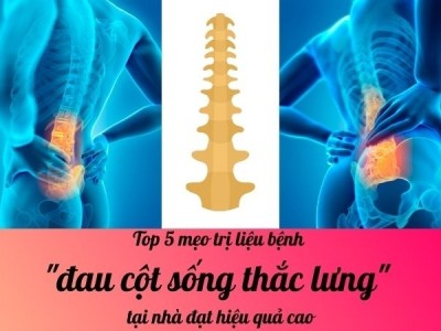 Top 5 mẹo trị liệu bệnh đau cột sống thắc lưng tại nhà đạt hiệu quả cao