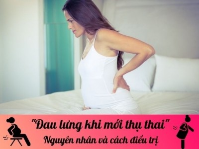 Đau lưng khi mới thụ thai: Nguyên nhân và cách điều trị