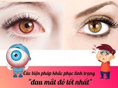 Các biện pháp khắc phục tình trạng đau mắt đỏ tốt nhất