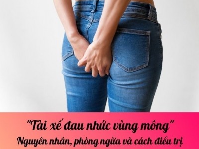 Tài xế đau nhức vùng mông: Nguyên nhân, phòng ngừa và cách điều trị 