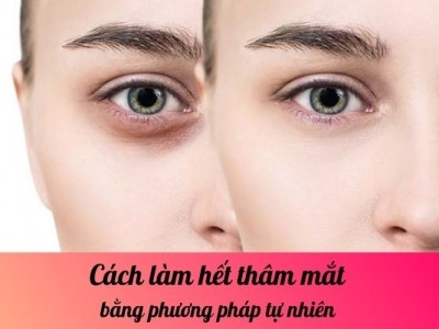 Cách làm hết thâm mắt bằng phương pháp tự nhiên 