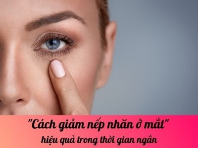 Cách giảm nếp nhăn ở mắt hiệu quả trong thời gian ngắn
