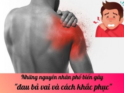 Những nguyên nhân phổ biến gây đau bả vai và cách khắc phục